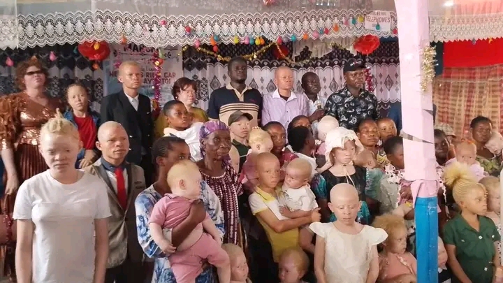 Kasaï Central : la CNDH défend les droits égaux des albinos